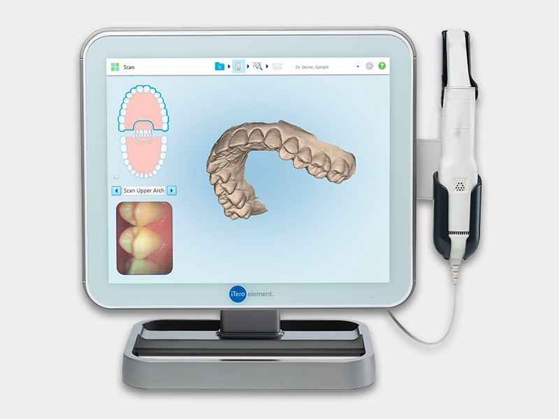 intraoral scanning